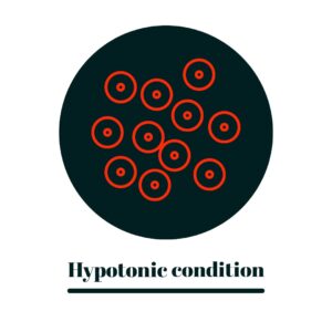hypotonic condition